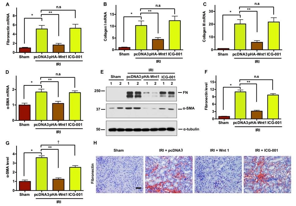 FIGURE 6 | In vivo expression of exogenous Wnt1 before IR reduces renal fibrosis in mice after AKI-CKD progression FIGURE 6 | In vivo expression of exogenous Wnt1 before IR reduces renal fibrosis in mice after AKI-CKD progression
