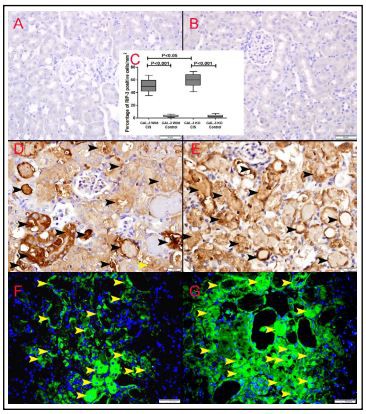 Fig. 7. A. Representative section  from kidneys of saline control  GAL-3 wild mice showing no expression of RIPK-3. B. Representative sections from kidneys of saline  control GAL-3 KO mice showing  no expression of RIPK-3.