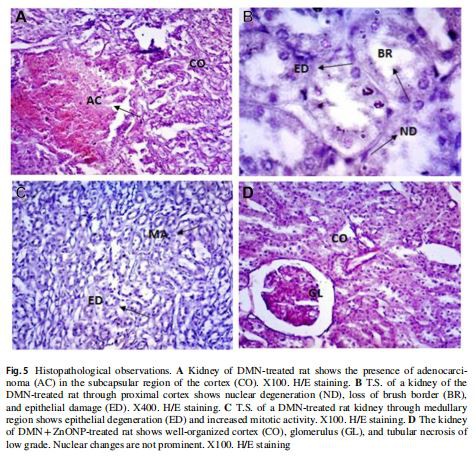 Histopathological observations. A Kidney of DMN-treated rat shows the presence of adenocarcinoma (AC) in the subcapsular region of the cortex (CO). X100. H/E staining. B T.S. of a kidney of the  DMN-treated rat through proximal cortex shows nuclear degeneration (ND), loss of brush border (BR),  and epithelial damage (ED). X400. H/E staining. C T.S. of a DMN-treated rat kidney through medullary  region shows epithelial degeneration (ED) and increased mitotic activity. X100. H/E staining. D The kidney  of DMN+ZnONP-treated rat shows well-organized cortex (CO), glomerulus (GL), and tubular necrosis of  low grade. Nuclear changes are not prominent. X100. H/E staining