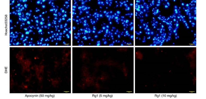 new research of chinese herbs for liver fibrosis